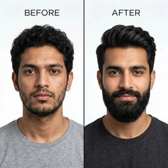 Dr. Alies Professional Beard Growth Oil | Natural Beard Care Oil for Patchy & Thin Beards | Moisturizing, Itch & Dandruff Care | 30ml
