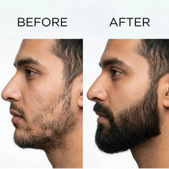 Dr. Alies Professional Beard Growth Oil | Natural Beard Care Oil for Patchy & Thin Beards | Moisturizing, Itch & Dandruff Care | 30ml